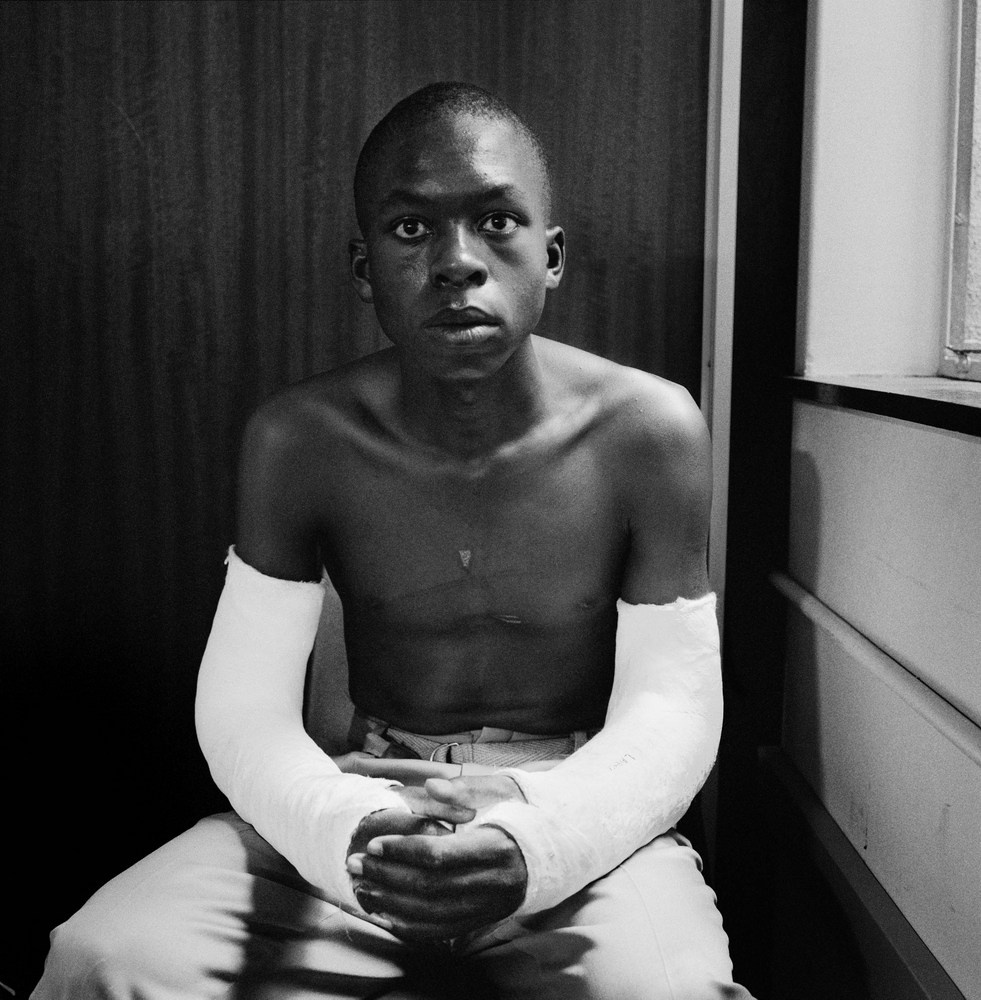 David Goldblatt's black-and-white photograph 'Fifteen-year-old Lawrence Matjee after his assault and detention by the Security Police, Khotso House, de Villiers Street' shows a seated boy, his two arms in casts.
